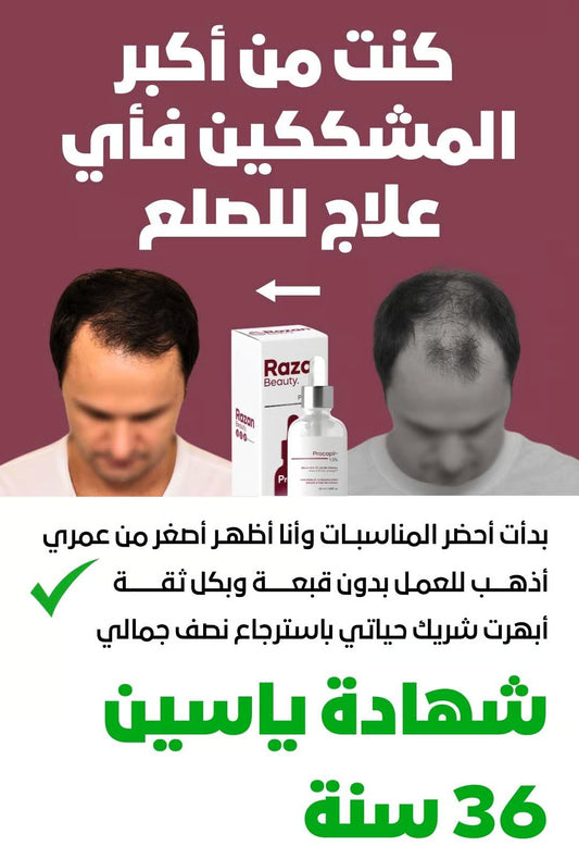 سيروم التساقط